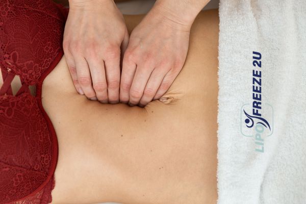 diastasis recti treatment Willenhall