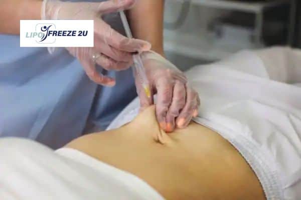 How Does Aqualyx Fat Dissolving Injection Work to Break Down Fat Willenhall?