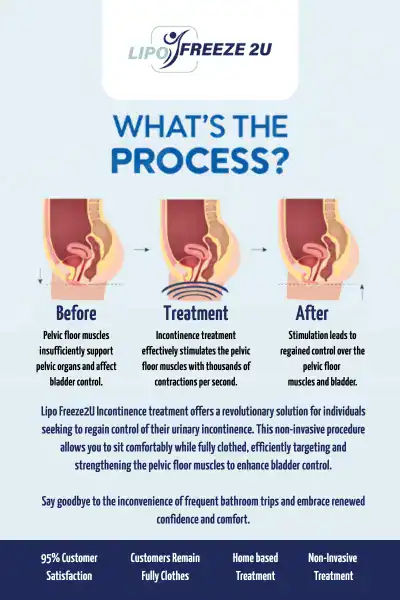 Diagram of how incontinence treatment Willenhall works.