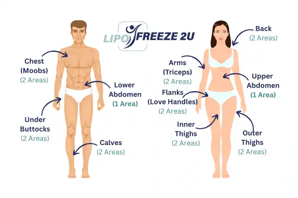 Areas you can have fat freezing treatment Willenhall