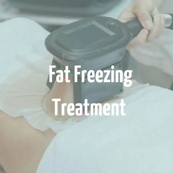 fat freezing treatment Willenhall