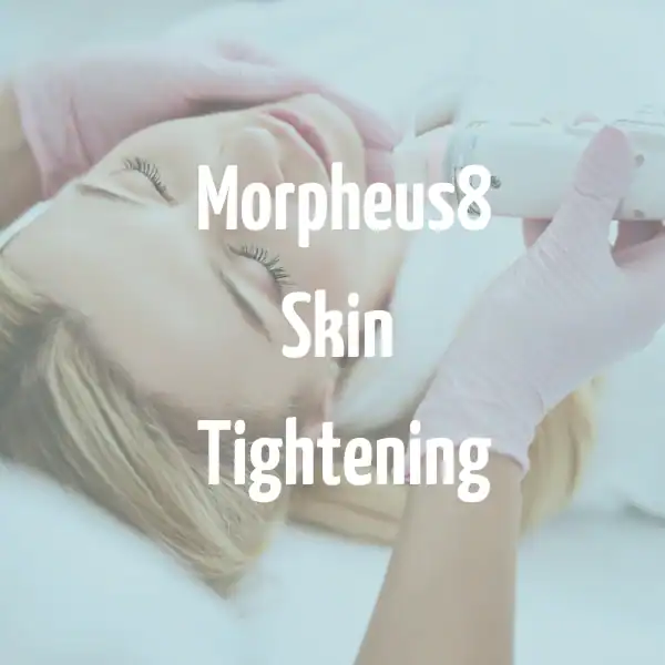 Morpheus8 skin tightening Willenhall