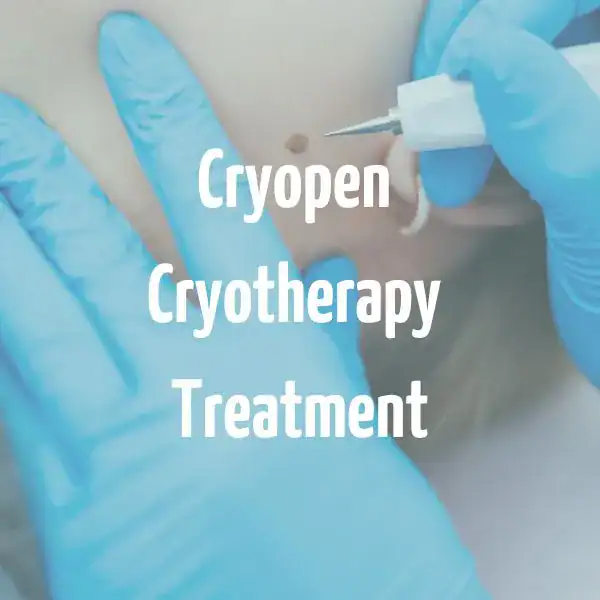 Cryopen Cryotherapy Treatment Willenhall