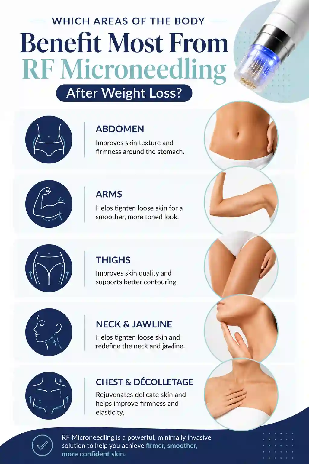 Which Areas of the Body Benefit Most From RF Microneedling After Weight Loss Willenhall