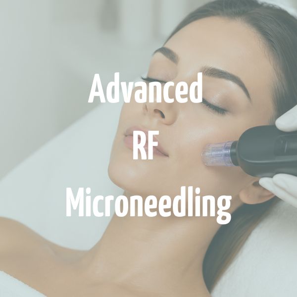 Advanced RF Microneedling Willenhall
